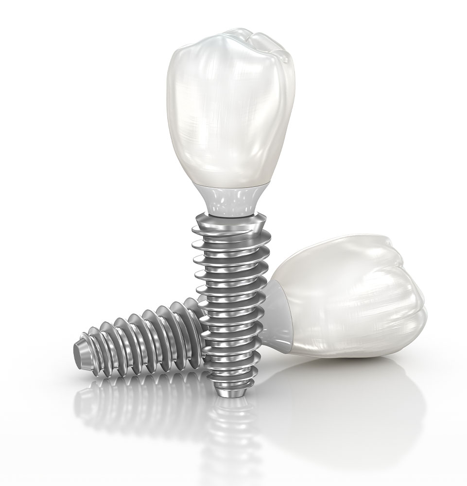 dental implants single