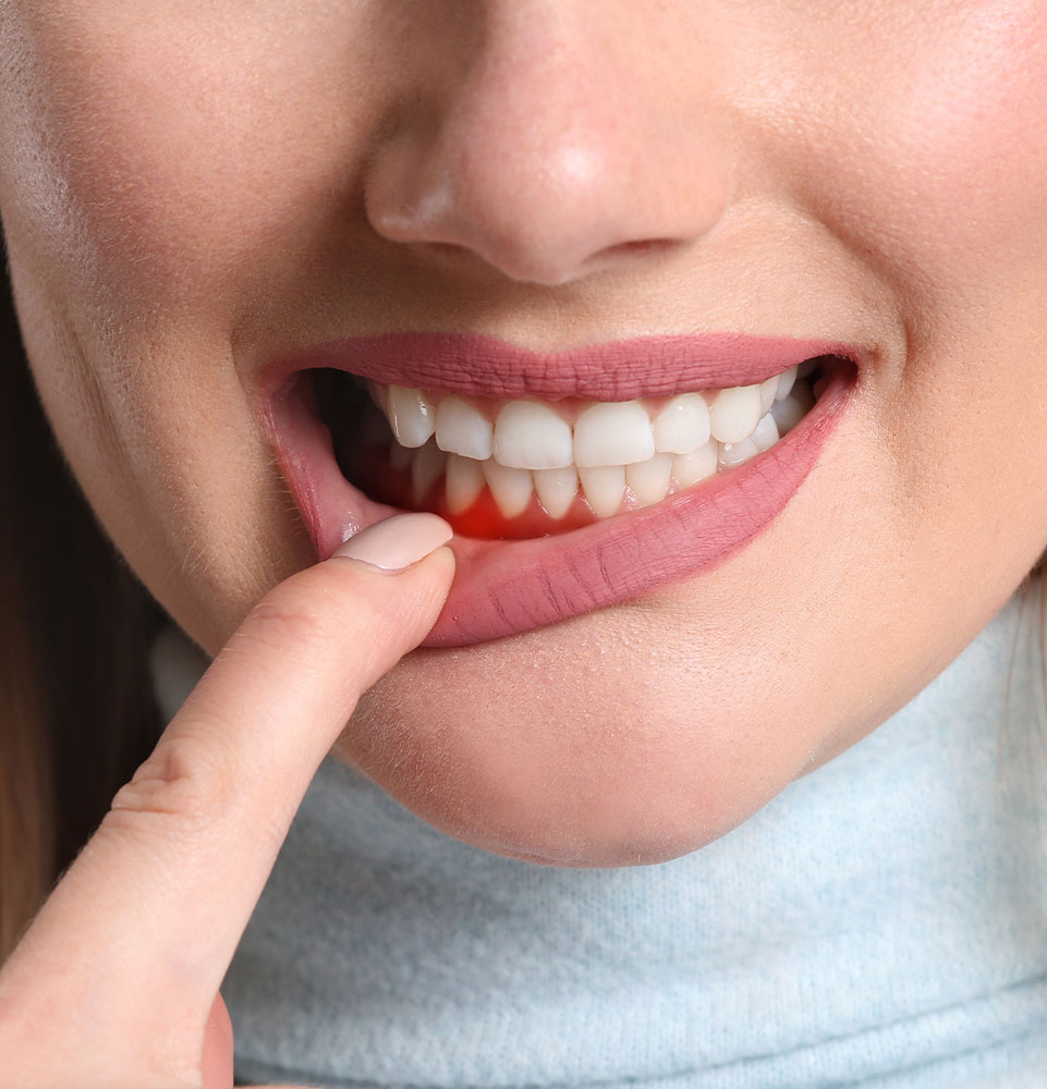 periodontal disease