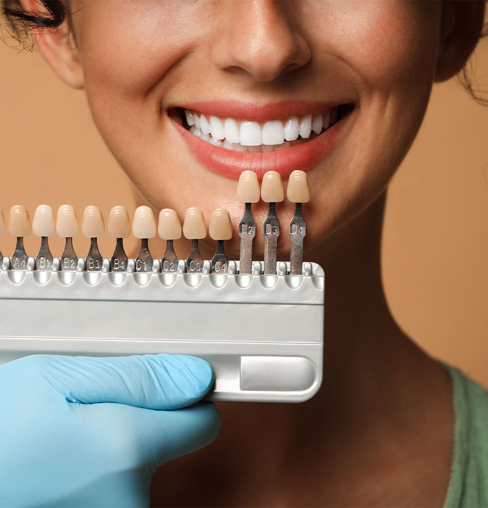 close up model trying on veneers