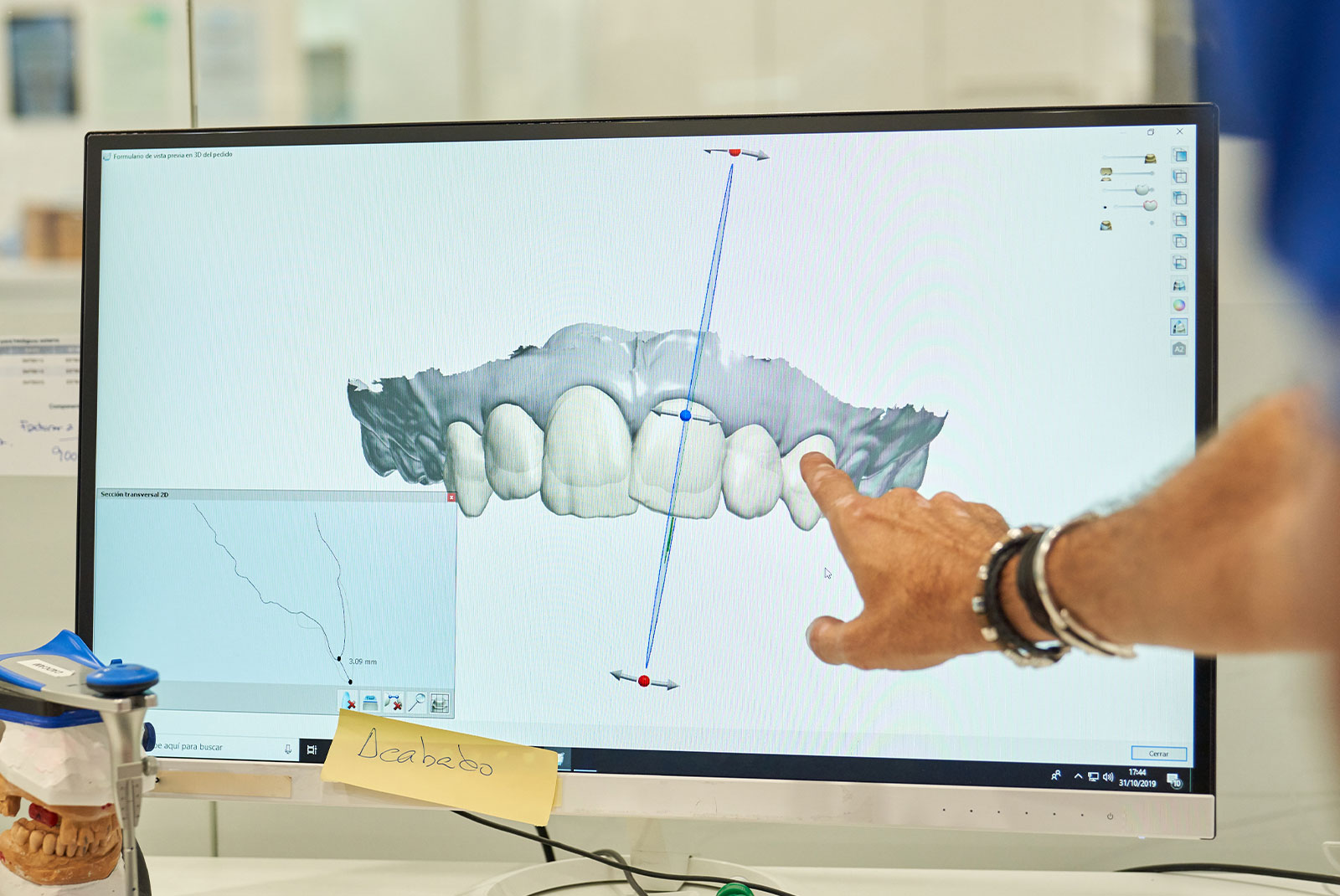 doctor pointing at 3d scan