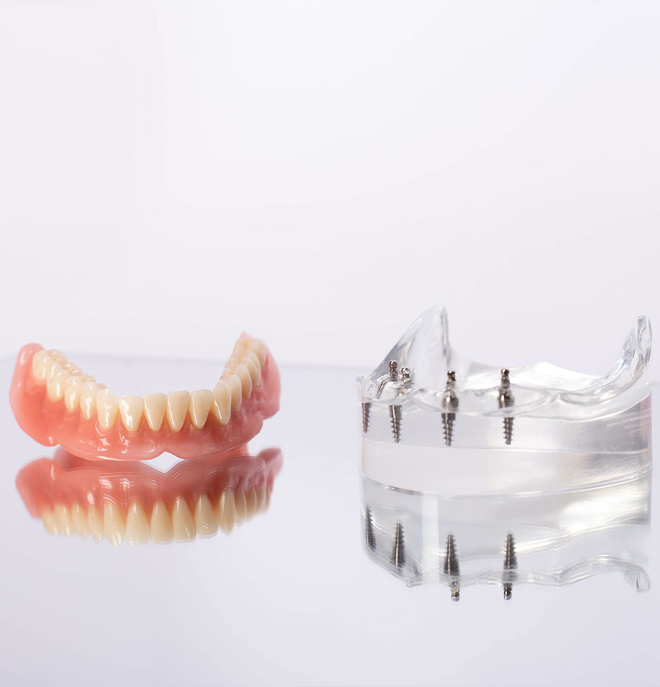 up close look of the dental implant model